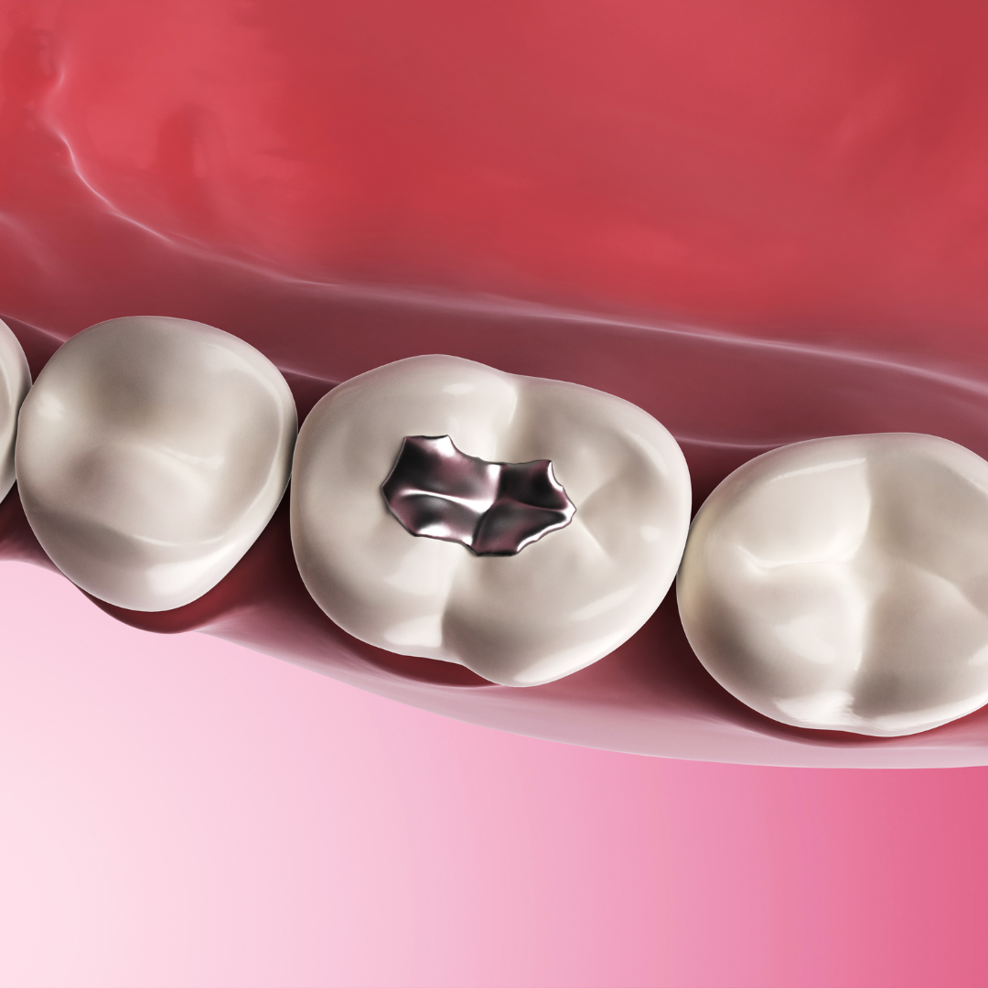 Blue Clean Dental Tips Instagram Post