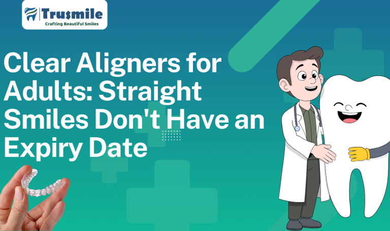 Clear Aligners for Adults: